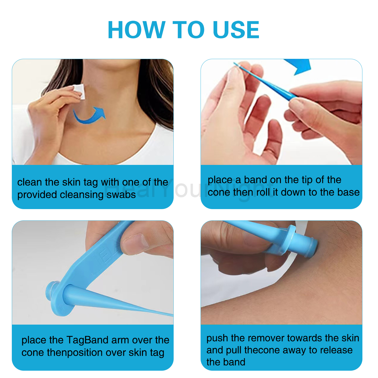 3-IN-1 Auto Skin Tag Removal K - огляд і ціна Acne Light Therapy Pen