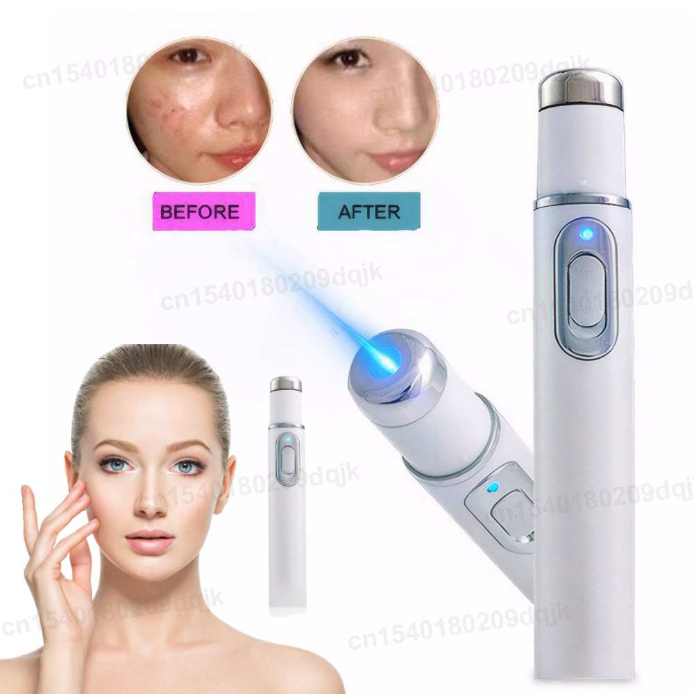Blue Light Therapy Acne Pen He - огляд і ціна Acne Light Therapy Pen
