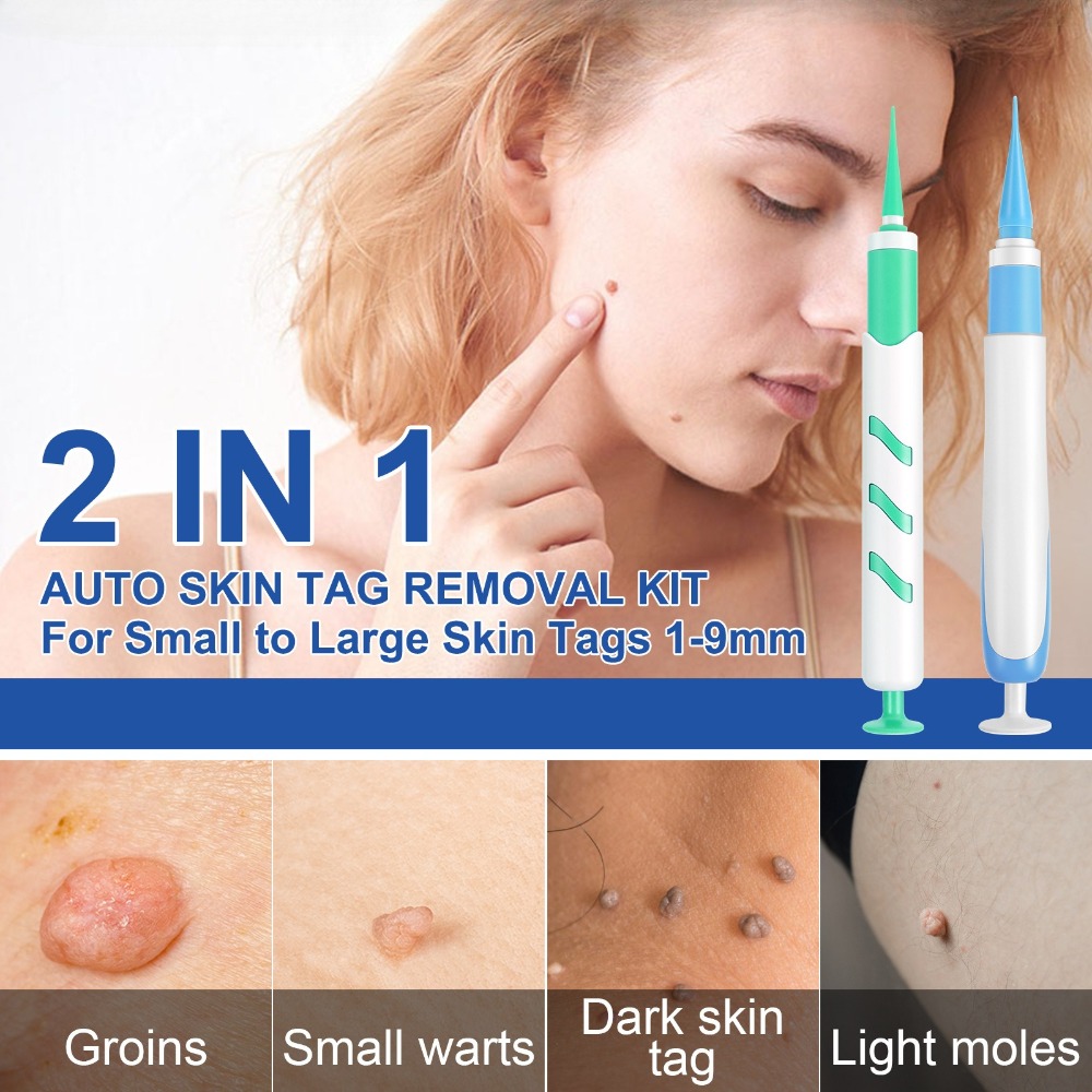 2-IN-1 Auto Skin Tag Removal T - огляд і ціна Acne Light Therapy Pen