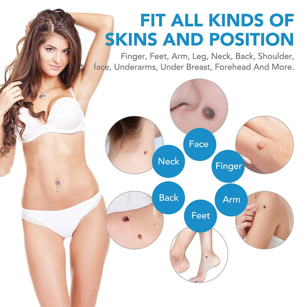 Auto Skin Tag Removal Tool Kit - огляд і ціна Acne Light Therapy Pen
