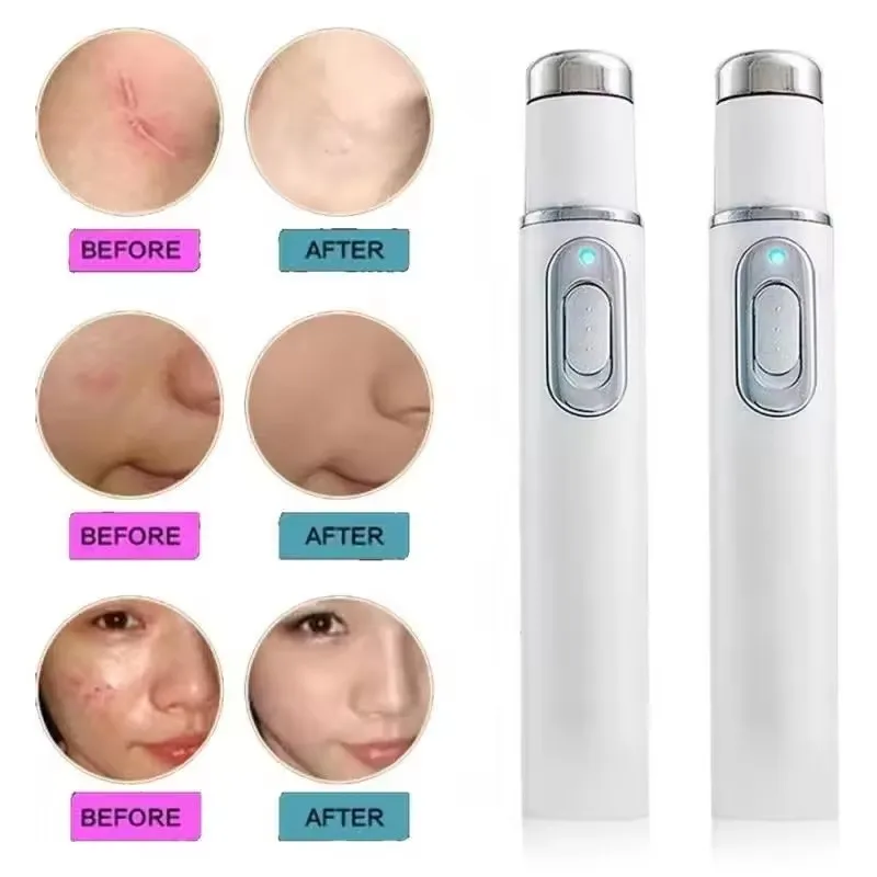 Blue Light Therapy Acne Pen Ey - огляд і ціна Acne Light Therapy Pen